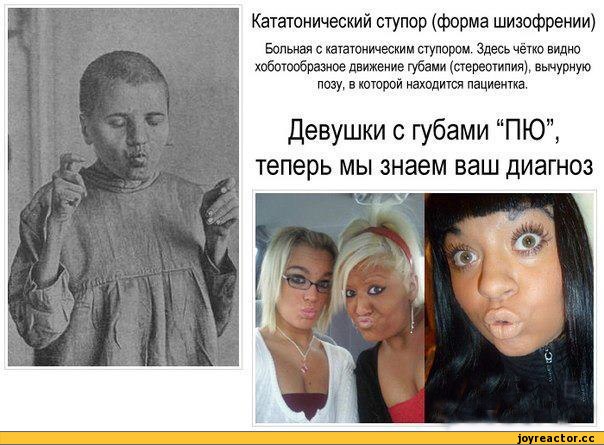 Компликации кататонического синдрома