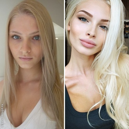 Шишкова до пластики