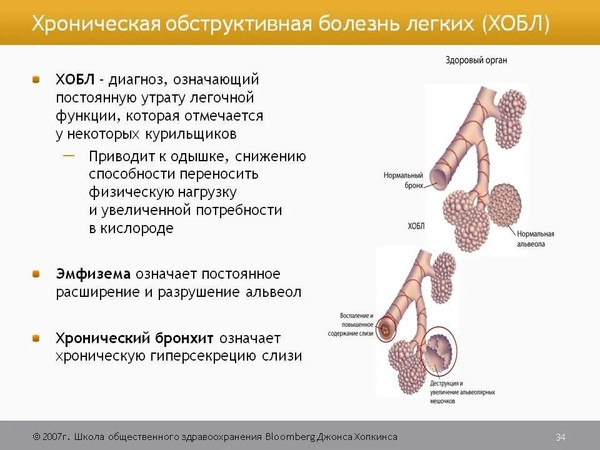 Отдышка как правильно пишется